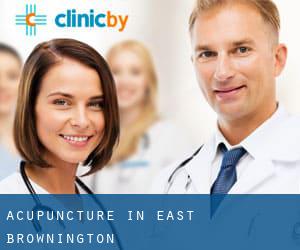 Acupuncture in East Brownington