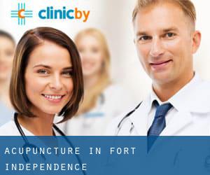 Acupuncture in Fort Independence
