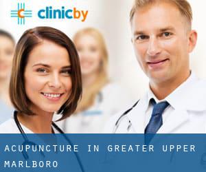 Acupuncture in Greater Upper Marlboro